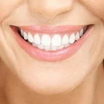 Dental Bonding and Contouring