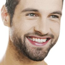Dental Bonding and Contouring